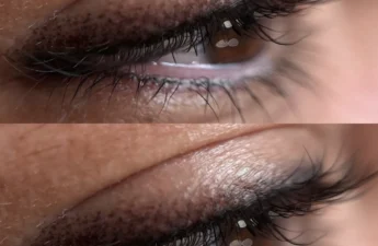 Does lash line tattoo work on oily eyelids