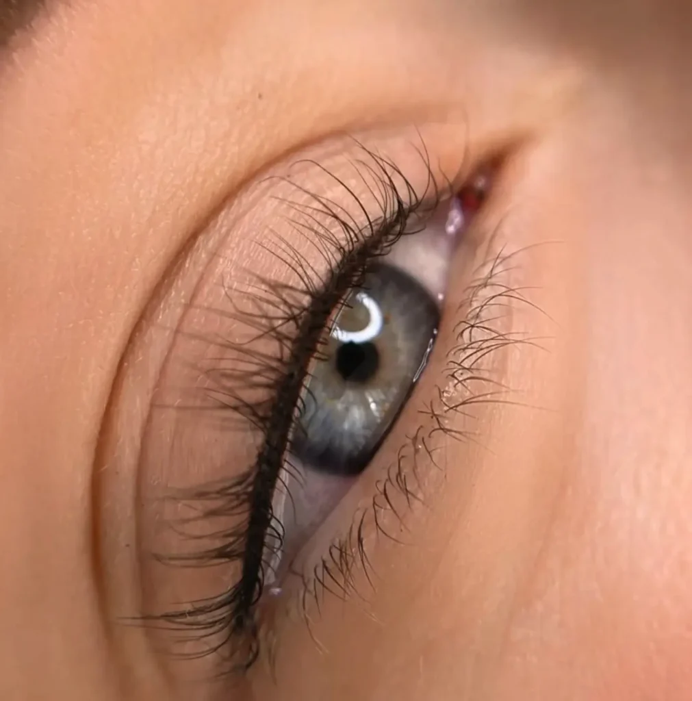 Pros & Cons for Oily Eyelids