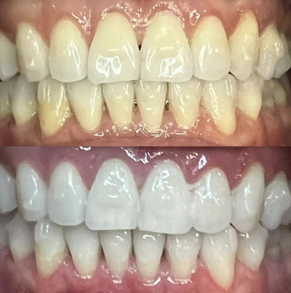 Step-by-Step Breakdown