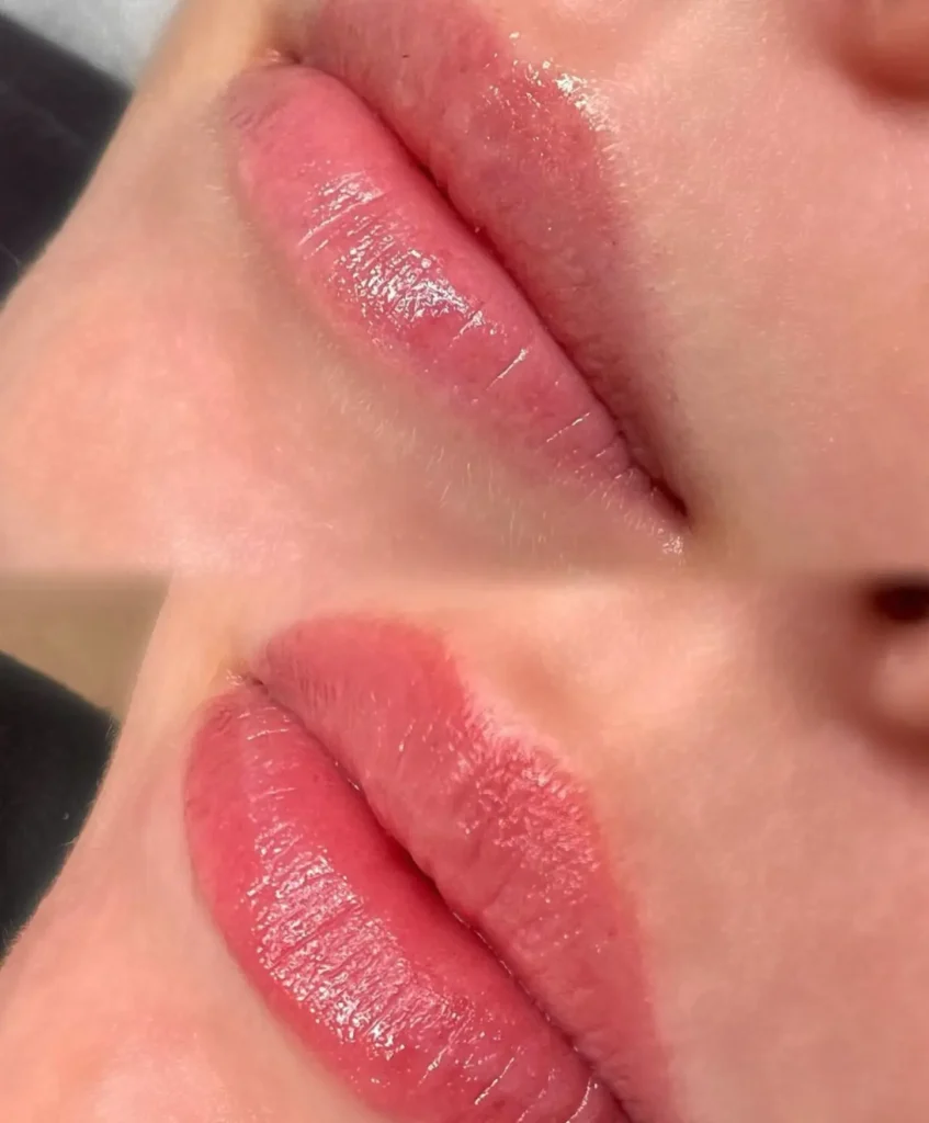 Purikelapa | What’s the Best Aftercare for Lip Neutralisation? What NOT to Do After Lip Lightening