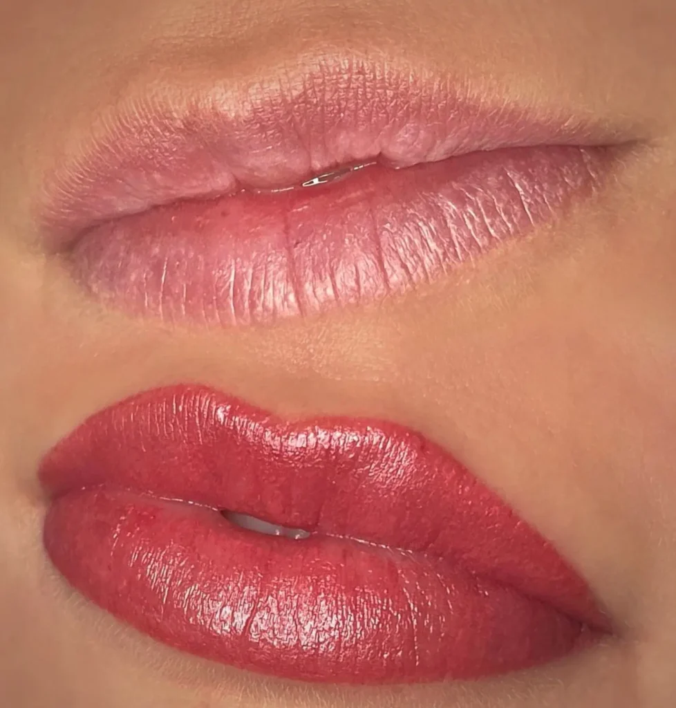 Purikelapa | What’s the Best Aftercare for Lip Neutralisation? What Products Should You Use